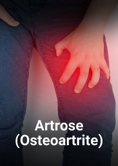 Artrose Osteoartrite