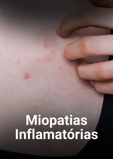 Miopatias Inflamatorias