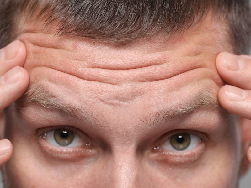 Tratamento para Arterite de Celulas Gigantes em Curitiba