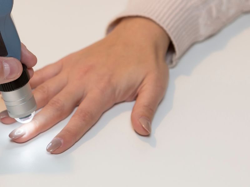 Tratamento para Esclerose Sistemica em Curitiba