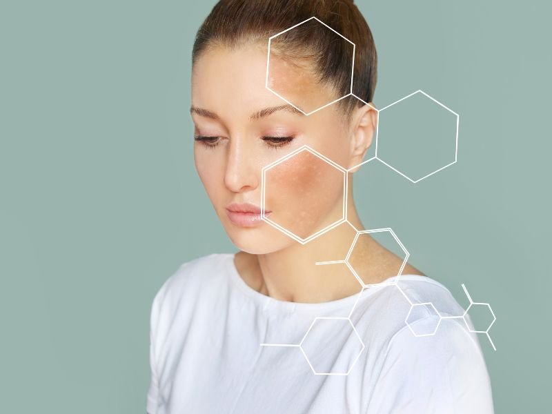 Tratamento para Lupus em Curitiba