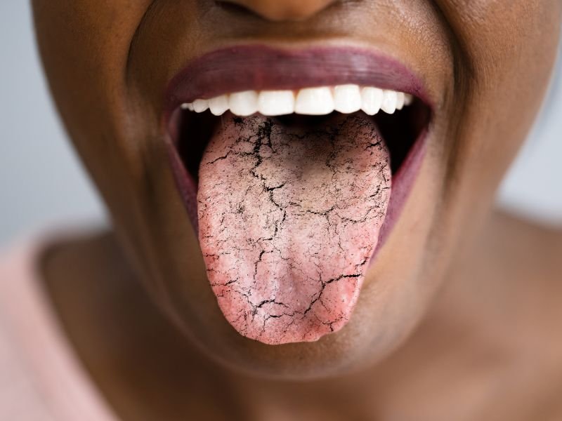 Tratamento para Sindrome de Sjogren em Curitiba