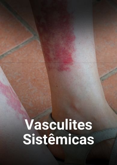Vasculites Sistemicas